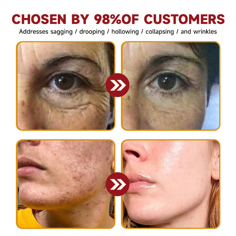 (🌿🐝Made and Shipped from Australia ✅) Warebrill™ Botox Bee Venom Anti-Aging Wrinkle Serum🔥LAST DAY SALE 80% OFF