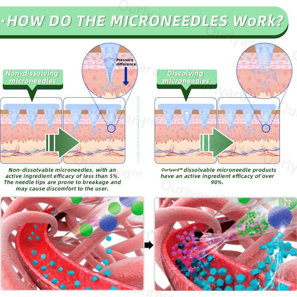 💧☘️Jorondy® SMGT-GLP-1 Nano-Microneedle Bottle (Zero Pain, 24/7 Release | Lose 20lbs FAST | 90% Sugar Drop | )