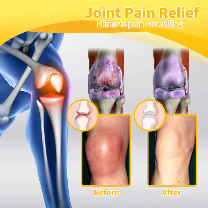 Jonordy™ Bee-Venom Pain-Relief Bone Healing Cream3👨⚕️Australian Orthopaedic Association (AOA) Recommend