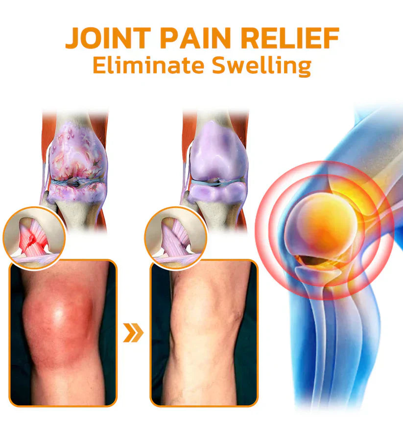 Jonordy™ Bee-Venom Pain-Relief Bone Healing Cream3👨⚕️Australian Orthopaedic Association (AOA) Recommend