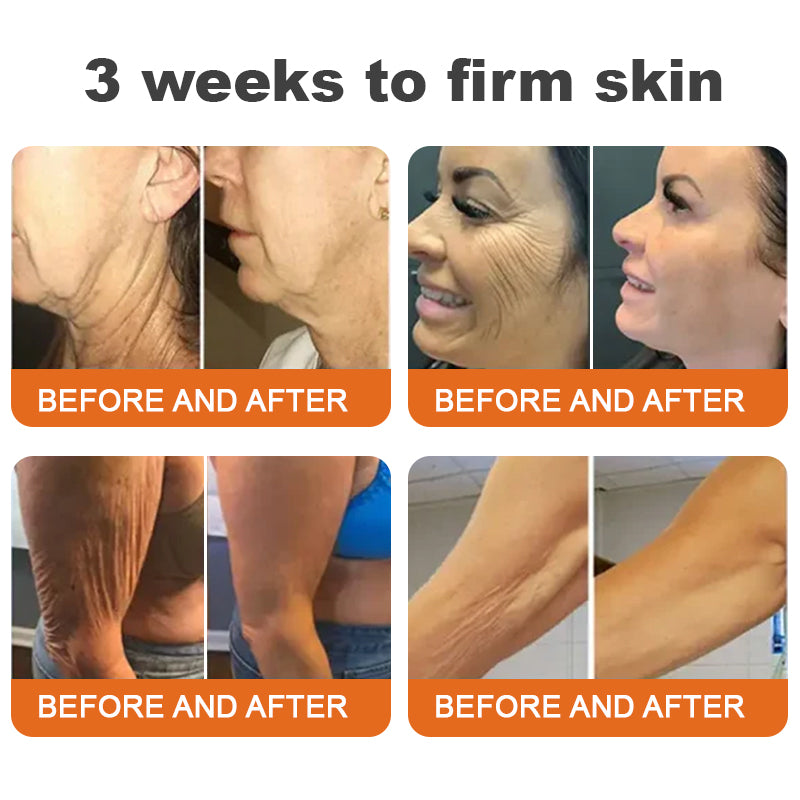 Jorondy™ Botox Bee Venom Firming Serum Stick🔥LAST DAY 70% OFF