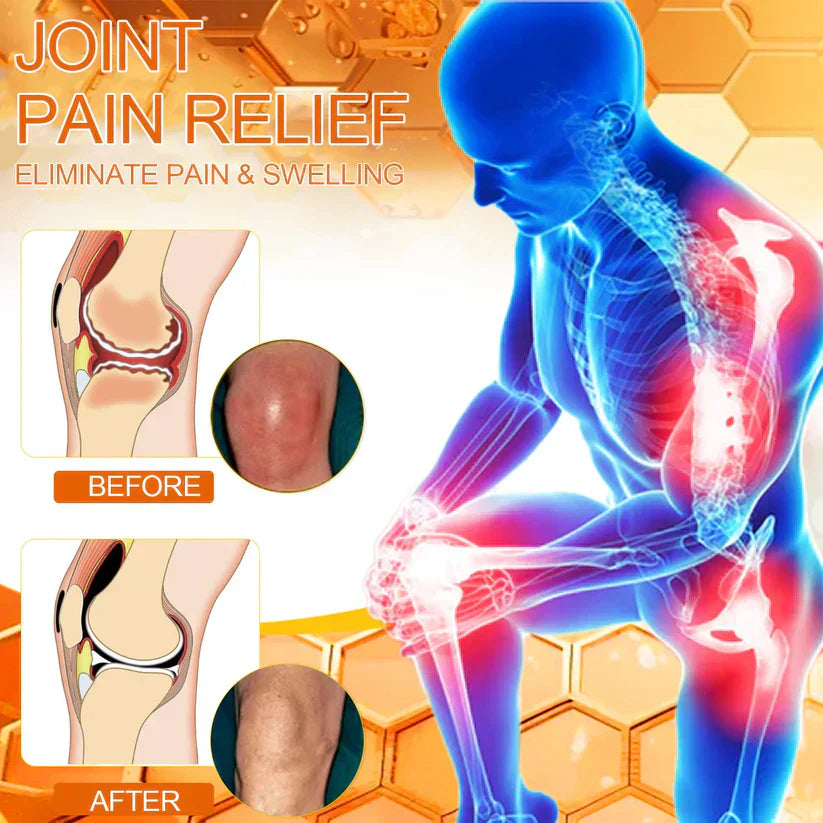 Jonordy™ Bee-Venom Pain-Relief Bone Healing Cream3👨⚕️Australian Orthopaedic Association (AOA) Recommend
