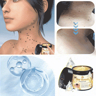 Turonuโข Bee Venom Treatment Cream for Scar Removal, Warts, Skin Tags, Tinea ๐