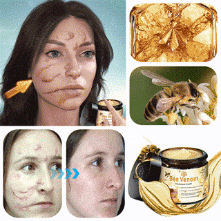 Turonuโข Bee Venom Treatment Cream for Scar Removal, Warts, Skin Tags, Tinea ๐