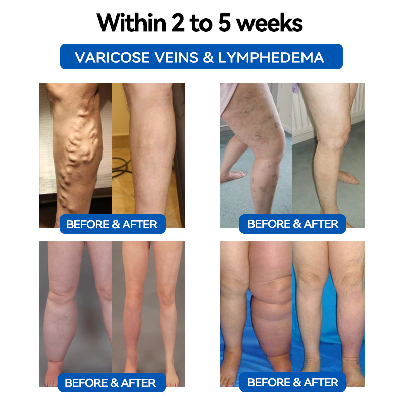 CZTICLE™ Ultrasonic Fat Blasting & Far Infrared Blood Sugar Balancing Detox Wristband(💖Recommended by PlasticSurgeons)