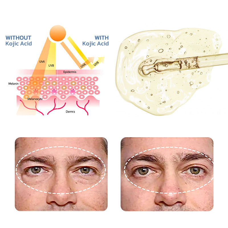 JORONDY Instant Eye Temporary Eye Tightener👀👀
