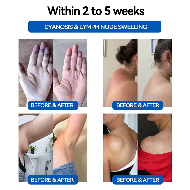 CZTICLE™ Ultrasonic Fat Blasting & Far Infrared Blood Sugar Balancing Detox Wristband(💖Recommended by PlasticSurgeons)