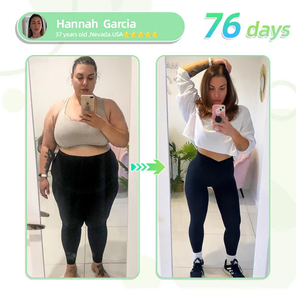 See results in 7 days🌲Jorondy™ SMGT-GLP-1 Nano Microneedle Patch(Painless, long-lasting, addressing diabetes, obesity, and cardiovascular diseases)