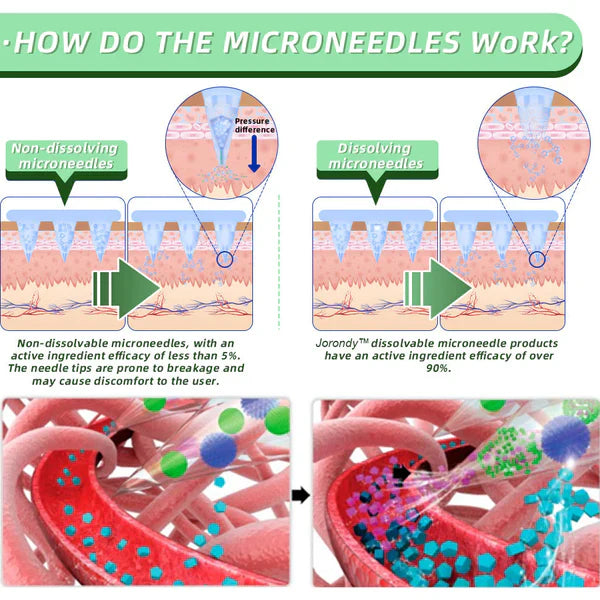 See results in 7 days🌲Jorondy™ SMGT-GLP-1 Nano Microneedle Patch(Painless, long-lasting, addressing diabetes, obesity, and cardiovascular diseases)