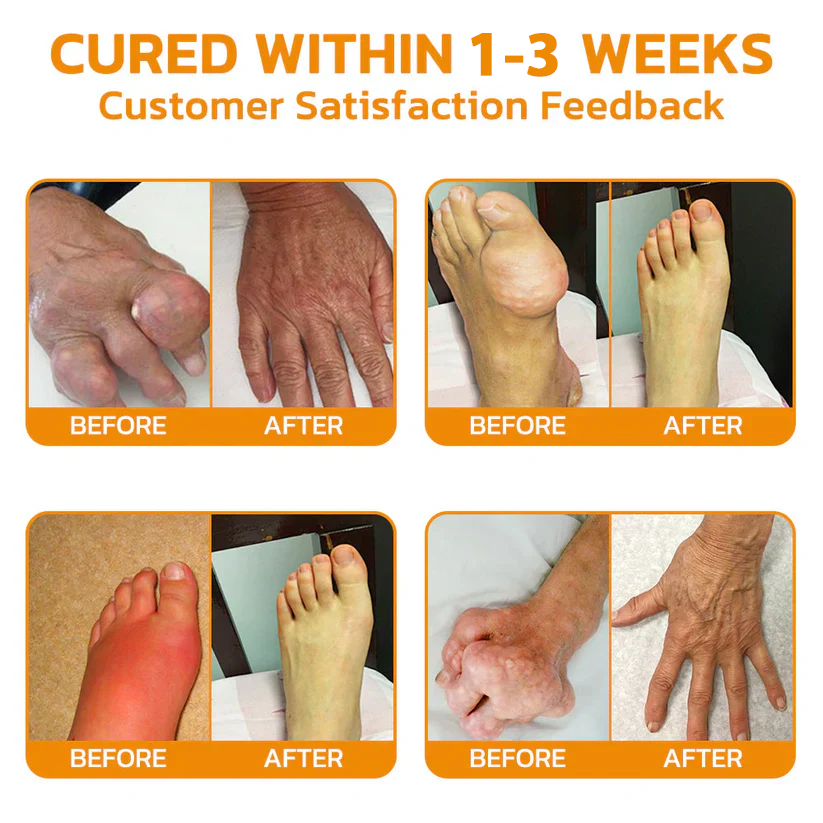 Jonordy™ Bee-Venom Pain-Relief Bone Healing Cream3👨⚕️Australian Orthopaedic Association (AOA) Recommend