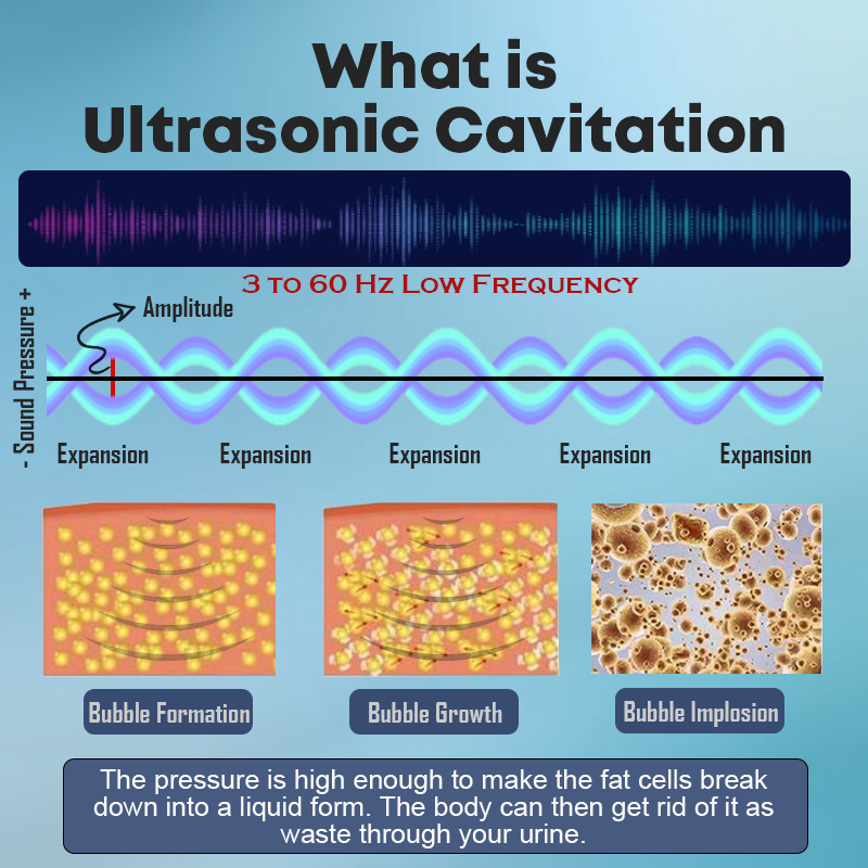 CZTICLE™ Ultrasonic Fat Blasting & Far Infrared Blood Sugar Balancing Detox Wristband(💖Recommended by PlasticSurgeons)