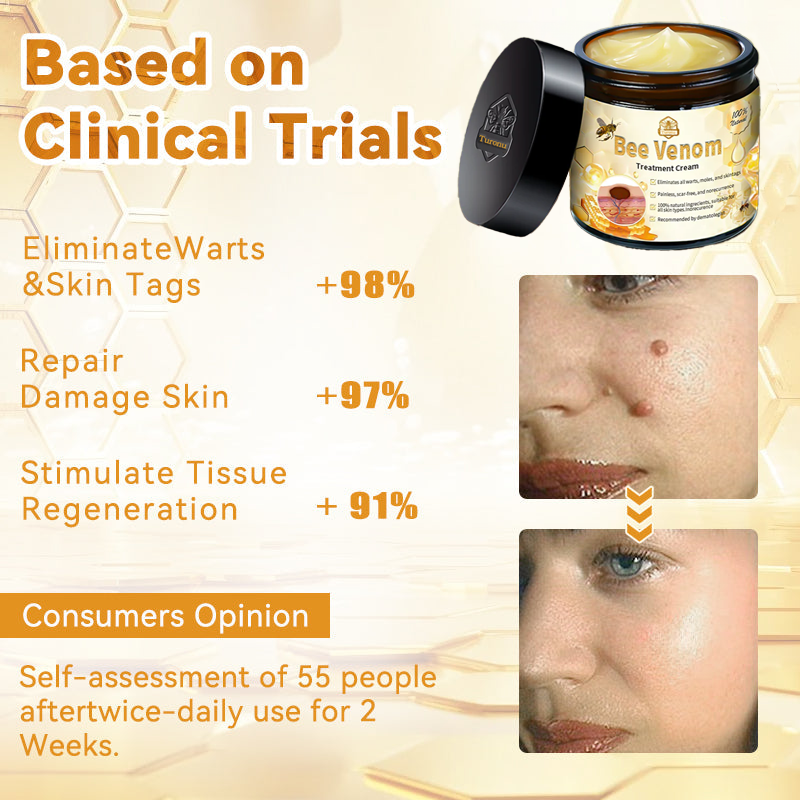 Turonuโข Bee Venom Treatment Cream for Scar Removal, Warts, Skin Tags, Tinea ๐